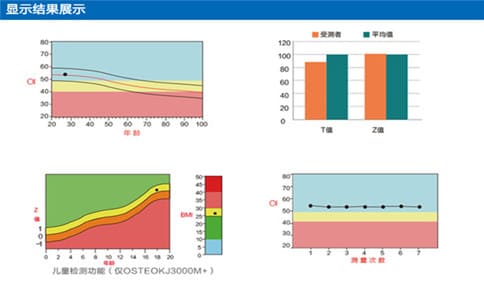 骨密度檢測(cè)